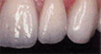 Before and After Picture